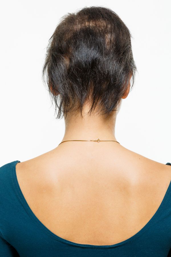 dünnes Haar ohne &lt;sup&gt;®&lt;/sup&gt;